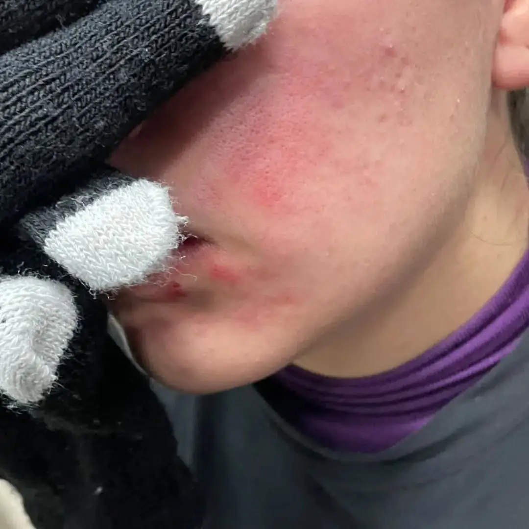 23/nov/2023. Ataque Porril en la FCA, UNAM